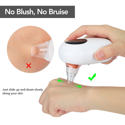 Blackhead Remover Vacuum Pore Cleaner Suction Cleaning Face Care Black Head Cleaner Acne Extractor Diamond Microdermabrasion eprolo