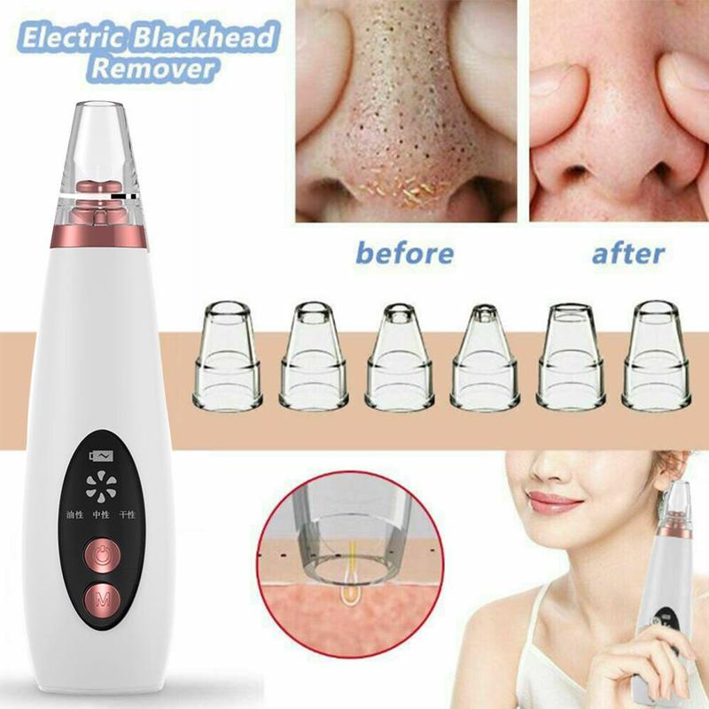 USB Blackhead Black Dot Remover Face Pore Vacuum Skin Care Acne Pore Cleaner Pimple Removal Vacuum Suction Facial Tools eprolo